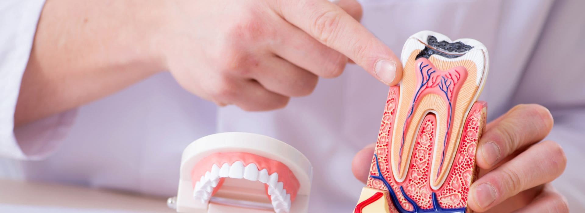 Empaste dental para tratar una caries en Zaragoza