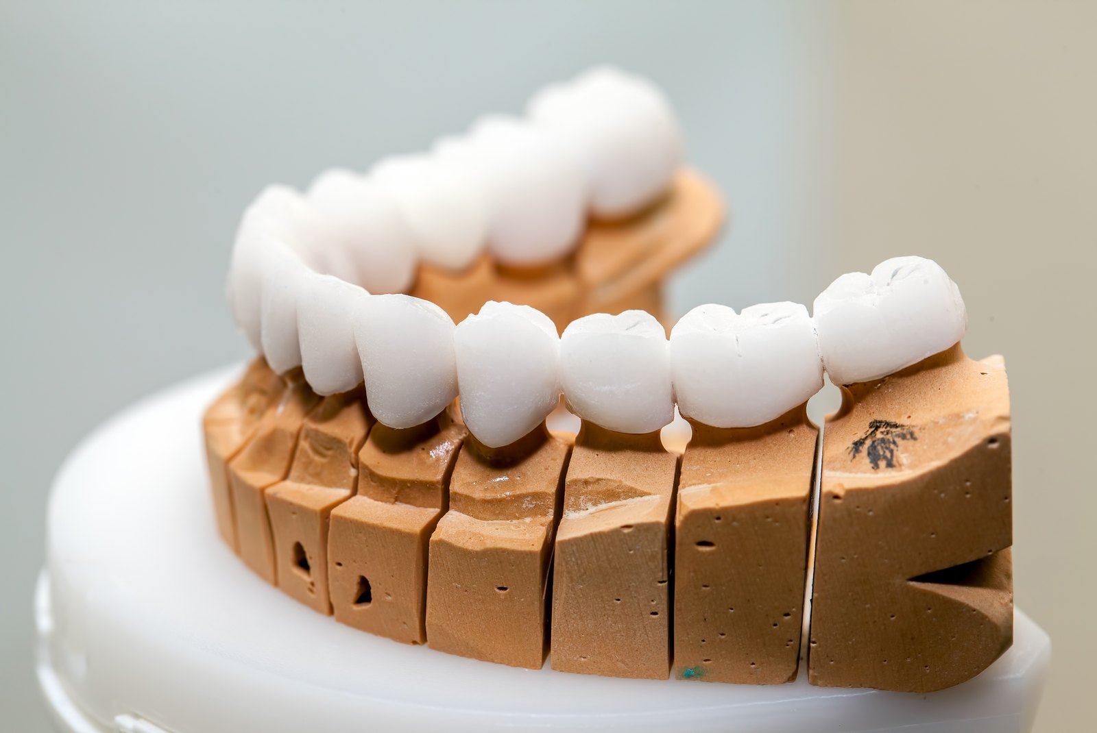 Puente completo de circonio sobre un modelo de arcada dental