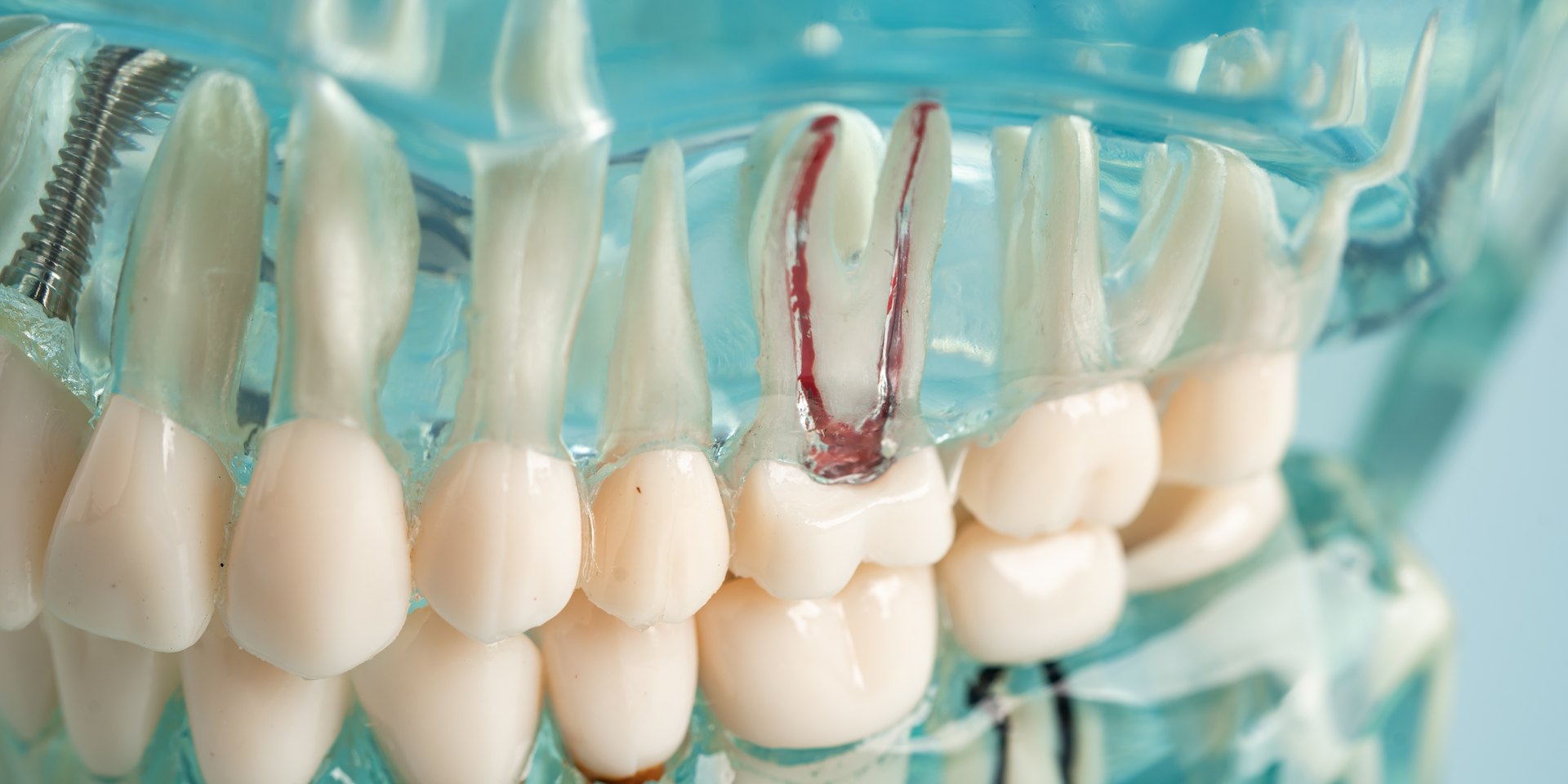 Maqueta transparente de una arcada dental con las raíces de los dientes dentro del hueso