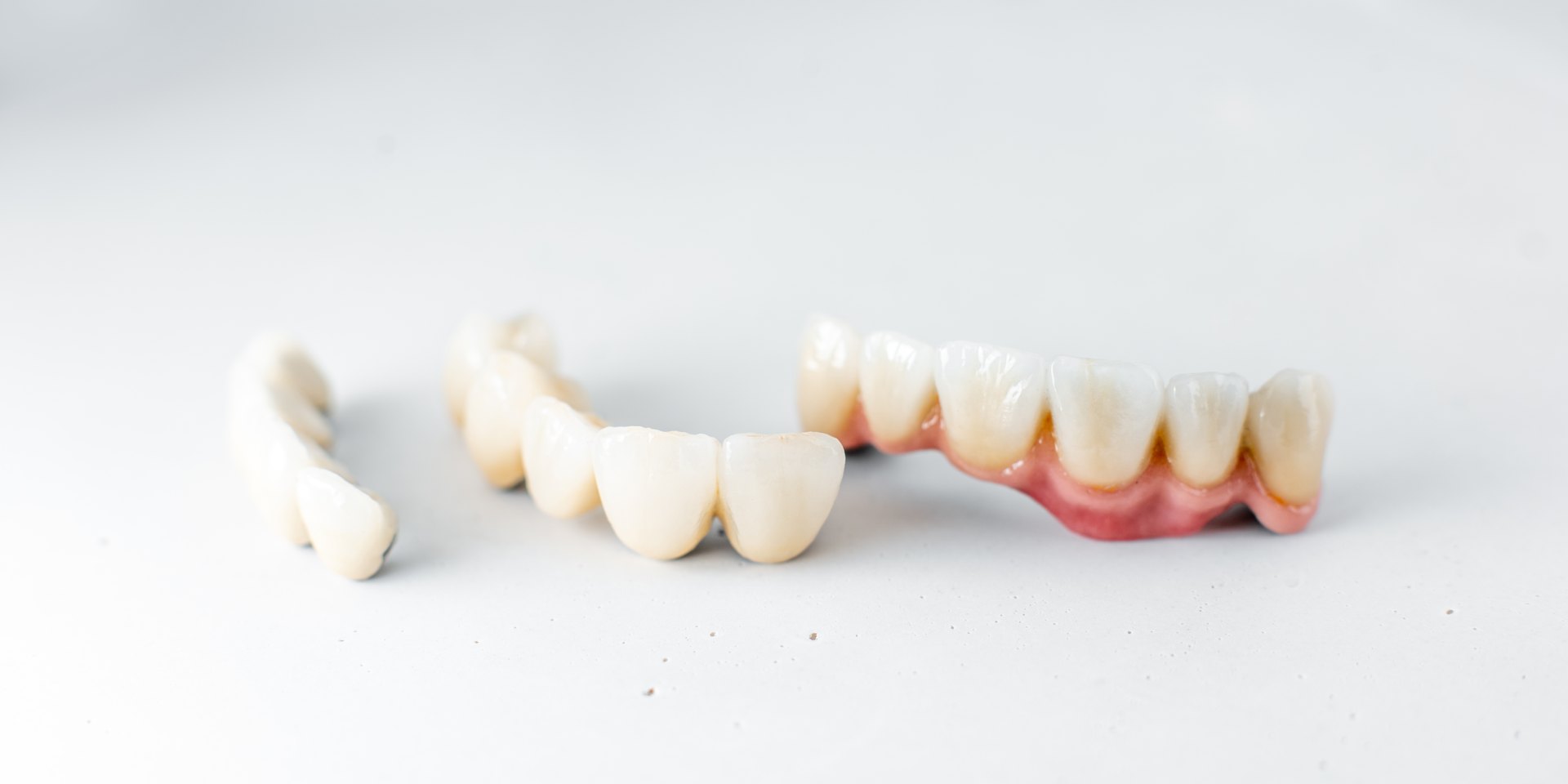 Coronas y puentes dentales de cerámica sobre una mesa blanca
