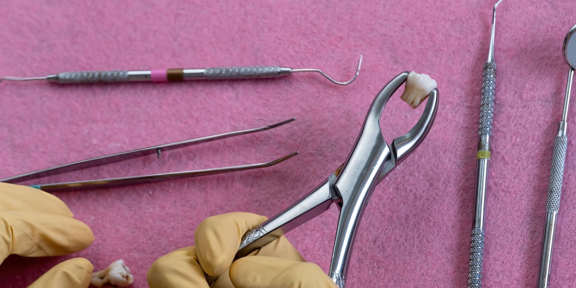 Fórceps dental sujetando una muela recién extraída, junto a otro instrumental