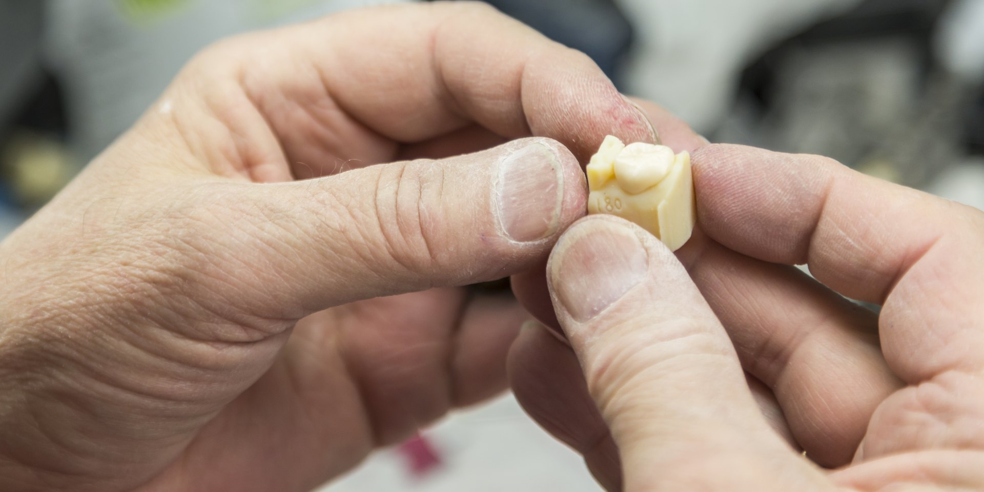 Manos de un técnico dental que sostienen una pieza impresa con dos dientes artificiales
