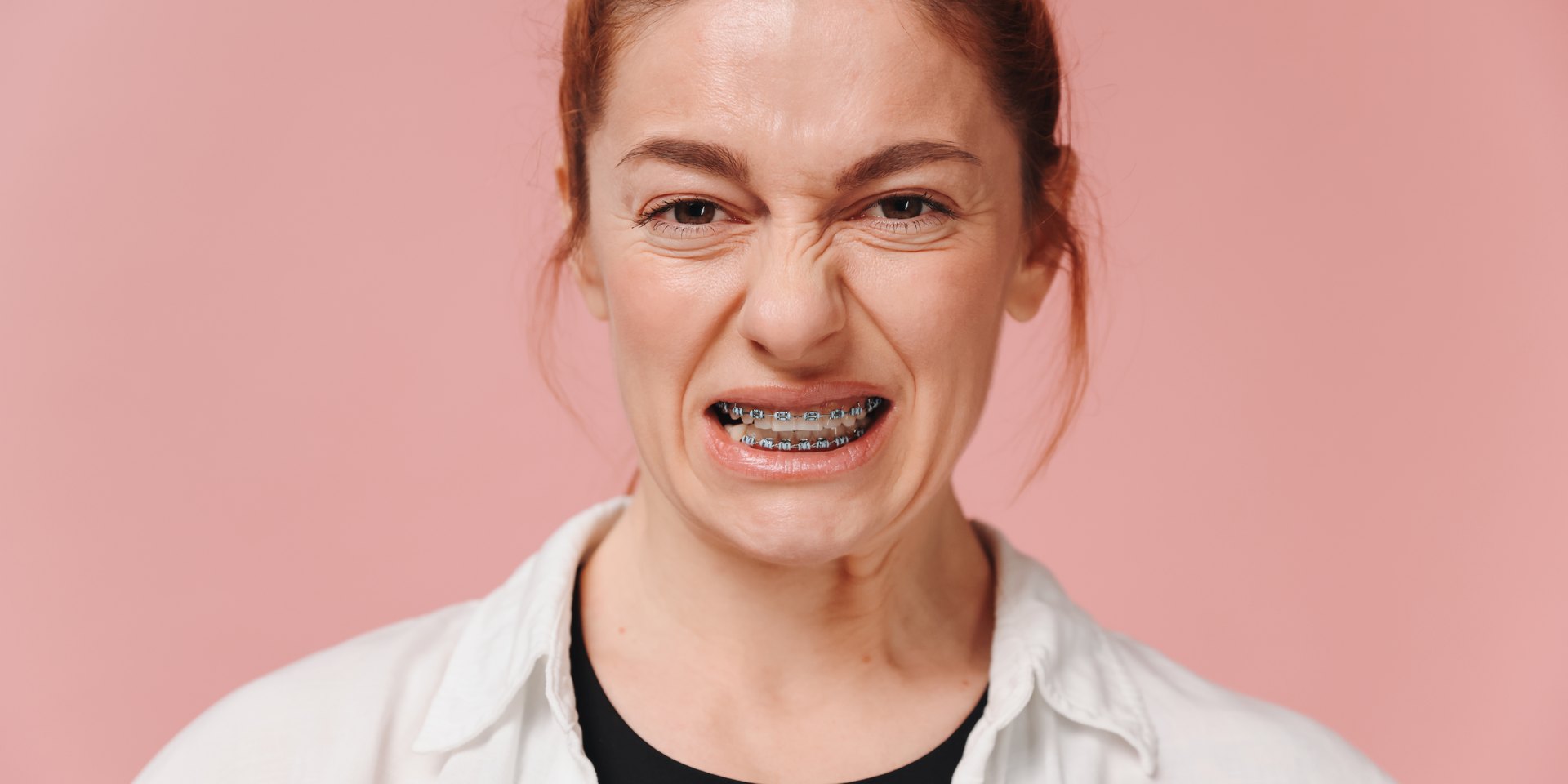 Mujer adulta con brackets en los dientes y gesto de molestia