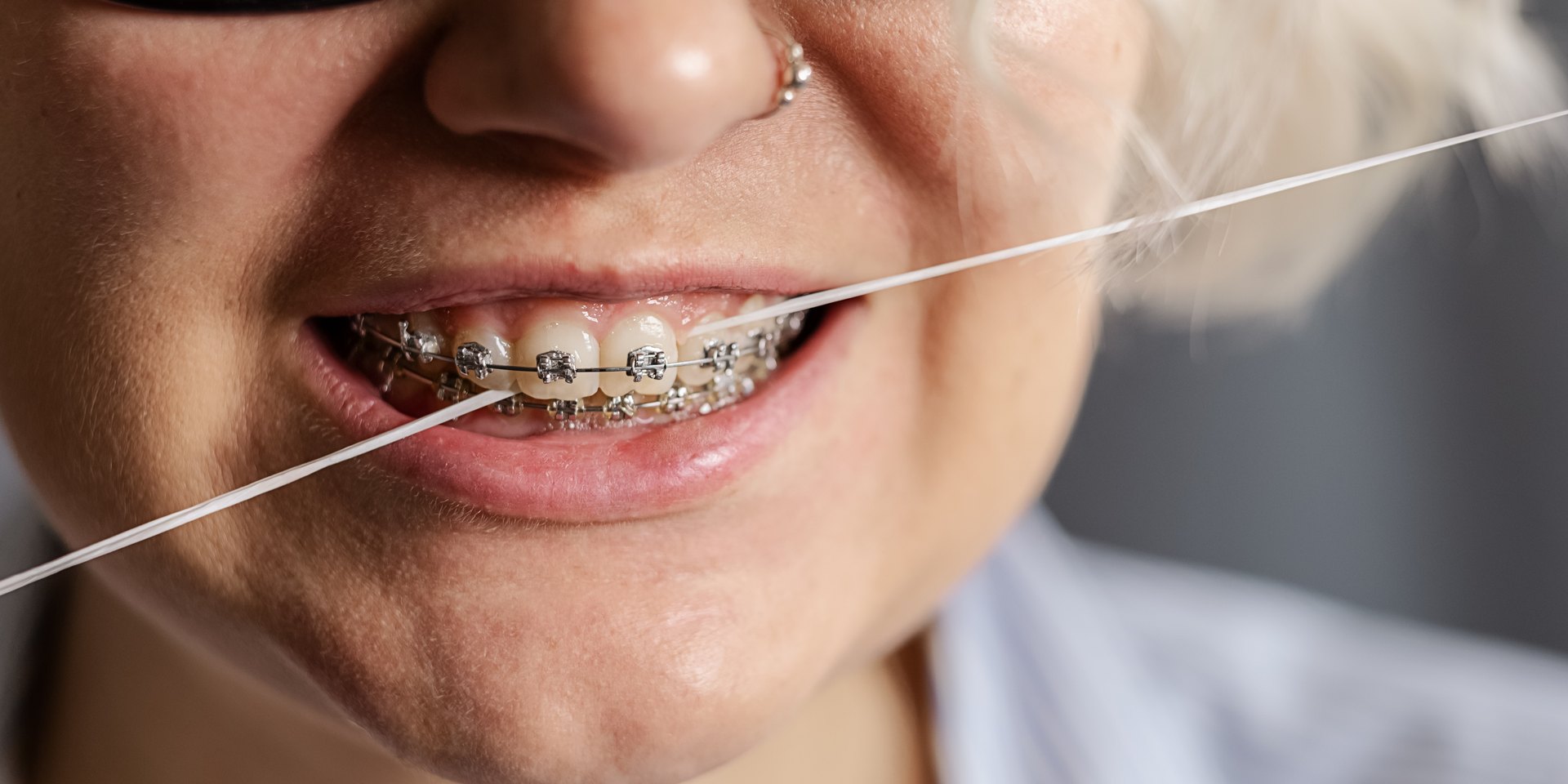 Mujer con brackets pasando hilo dental entre los dientes