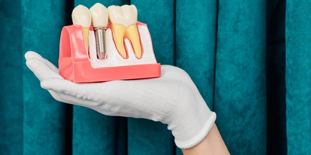 Mano con guante blanco sosteniendo un modelo de implante dental entre dos dientes delante de una cortina verde azulada
