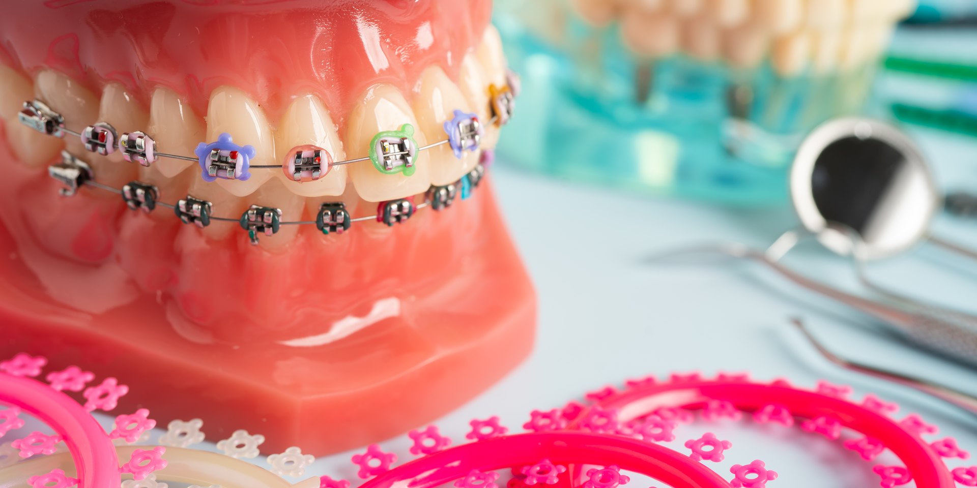 Modelo dental con brackets metálicos y ligaduras de colores junto al instrumental de ortodoncia