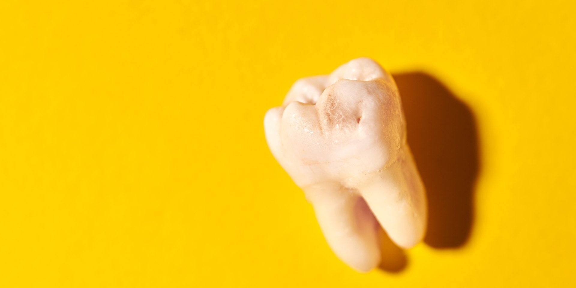 Muela del juicio extraída sobre un fondo amarillo