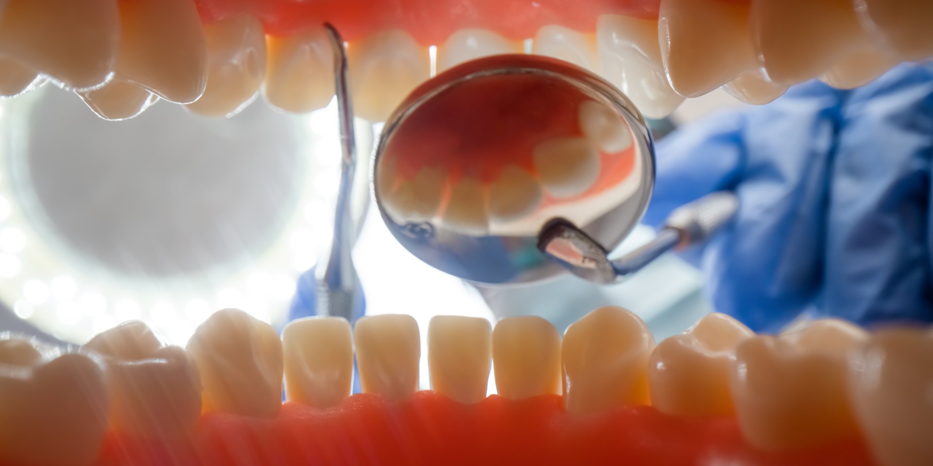 Vista desde dentro de la boca abierta con el espejo del dentista reflejando los dientes de arriba