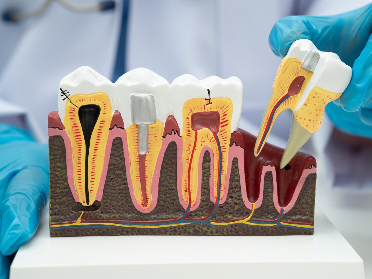 Maqueta de dientes en corte con el esmalte, la dentina, la pulpa y las raíces dentro del hueso
