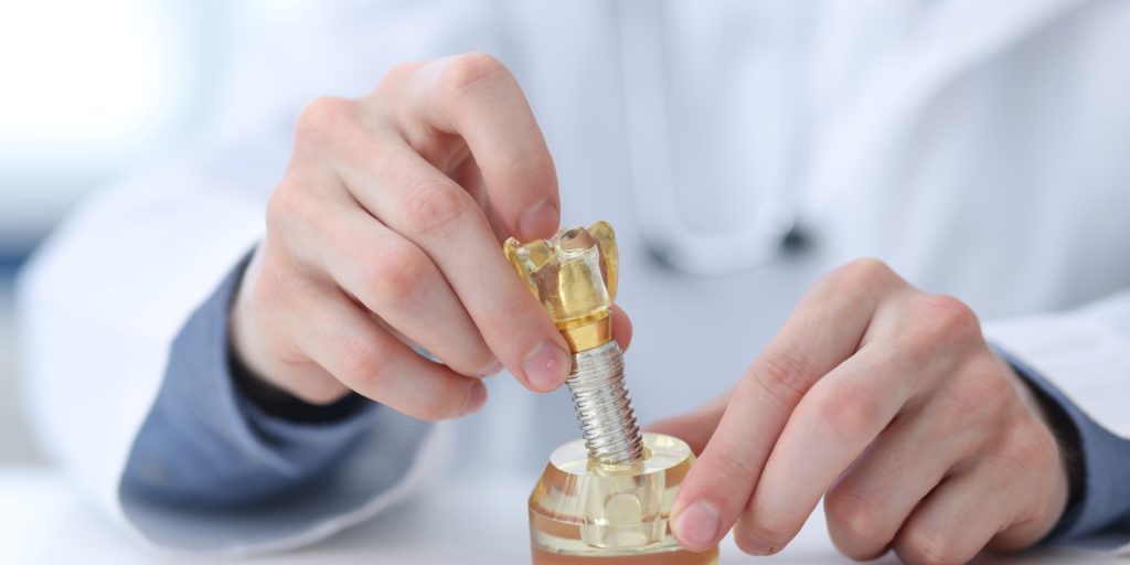 Dentista montando la corona sobre un modelo de implante dental