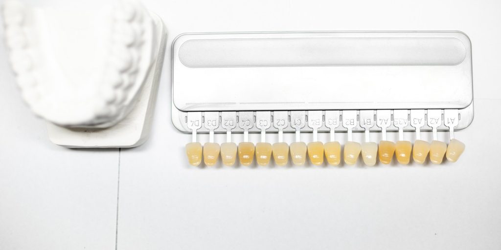 Guía de colores dentales junto a un modelo de escayola para elegir el tono de las carillas