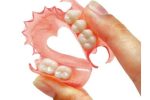 REMOVABLE DENTURES WITHOUT HOOKS