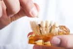 WHAT HAPPENS IF I HAVE A DENTAL IMPLANT MOVED?